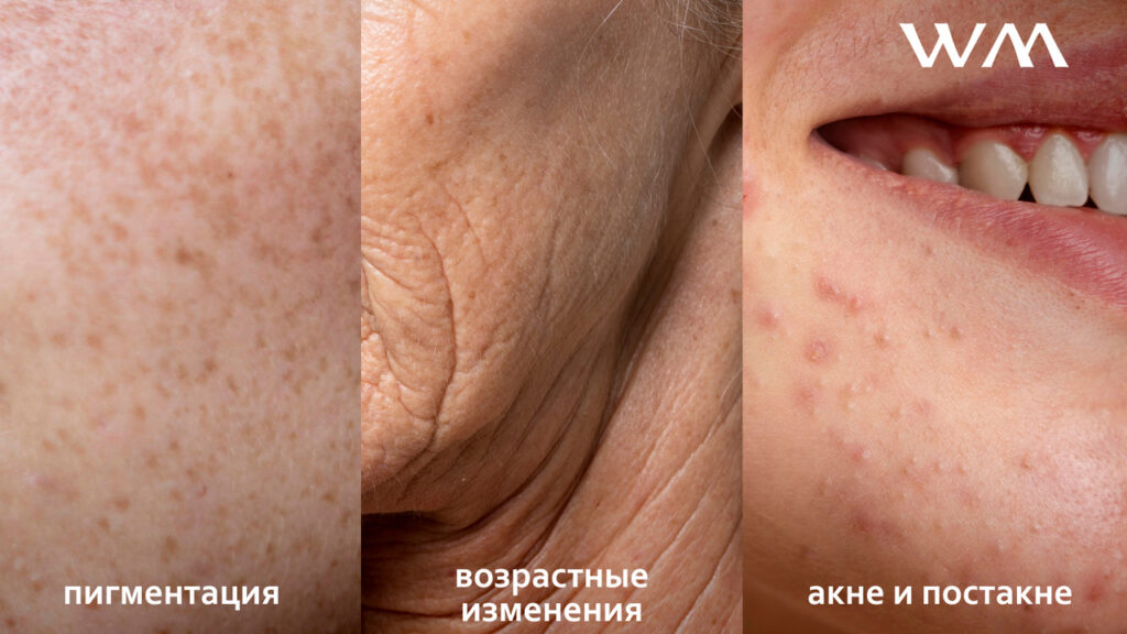 БЛОГА - ВСЕЙ ПРАВДА ОРЕТИНОЛЕ: О.